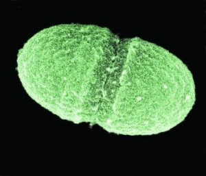 Afb. 6: Enterococcus Faecalis